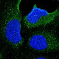 KLHDC8B Antibody, Novus Biologicals 0.1mL; Unlabeled:Antibodies, Polyclonal